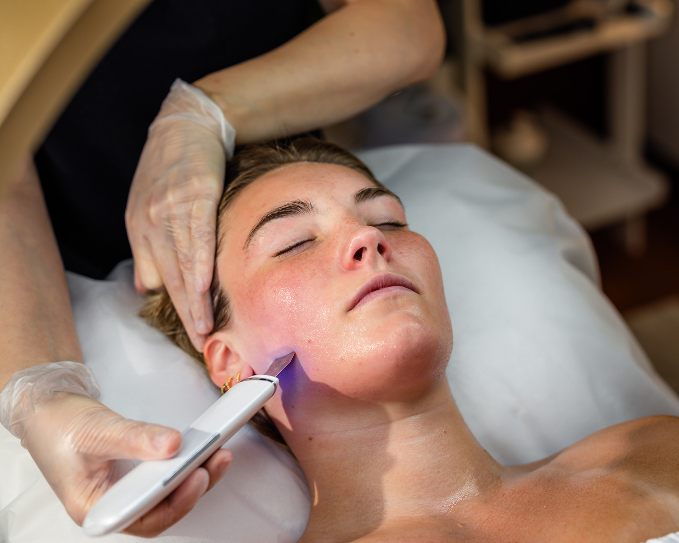 Καθαρισμός Προσώπου σε γυναίκα